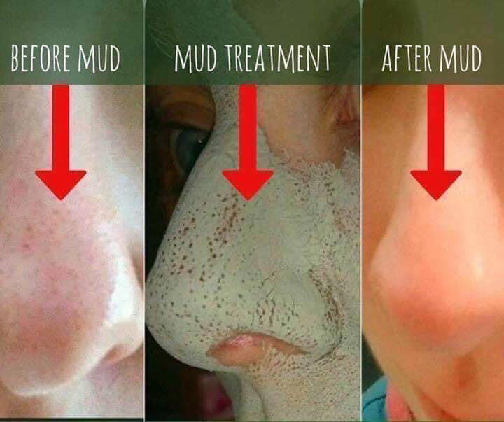 Epoch® Glacial Marine Mud