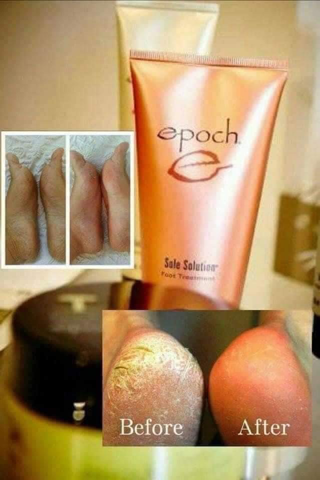 Sole Solution Foot Treatment