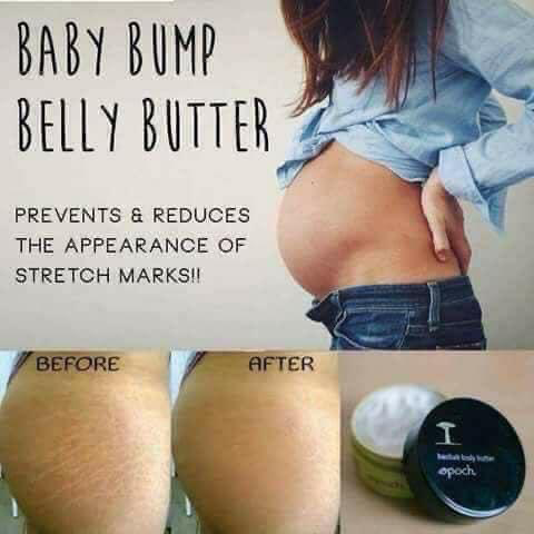 Stretch Mark Cream
