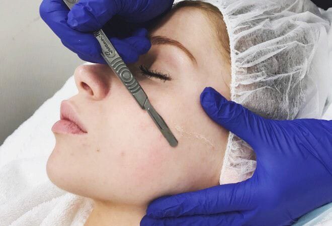 LIMPIEZA PROFUNDA + DERMAPLANING + HIDRATACION