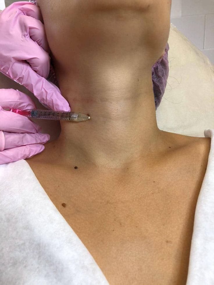 Hidratación Cuello
