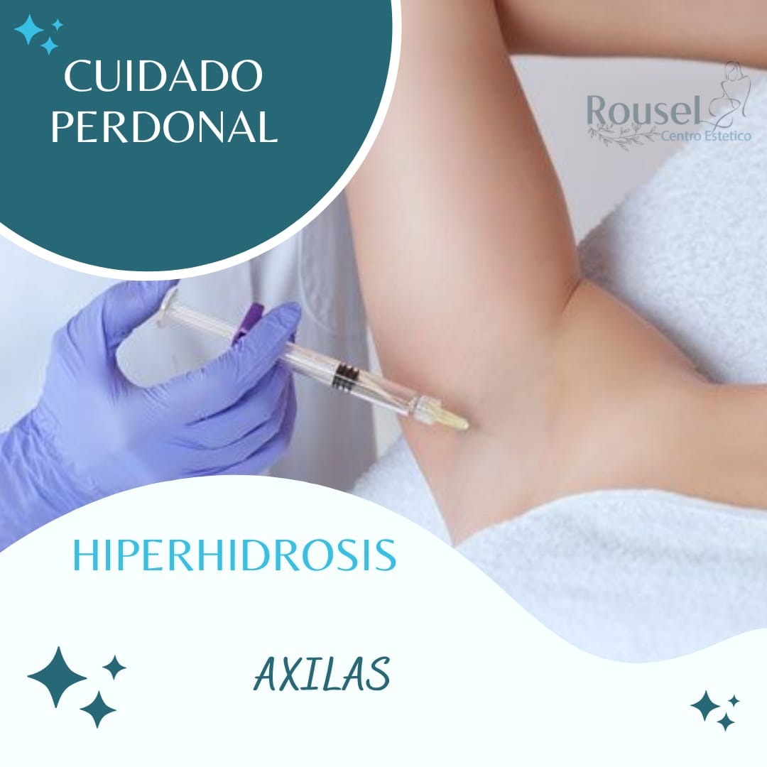 HIIPERHIDROSIS