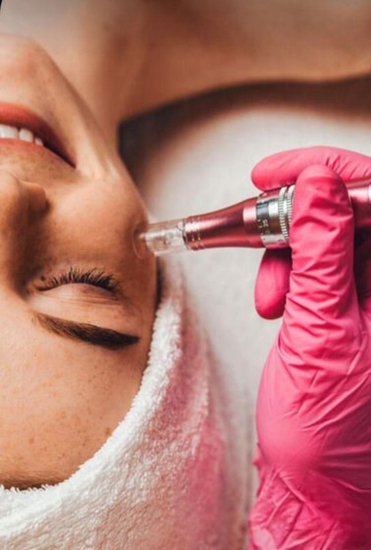 Dermapen Facial
