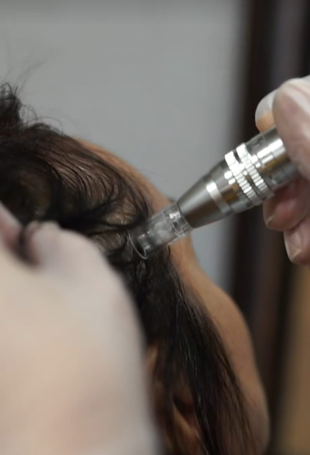 DERMAPEN CAPILAR