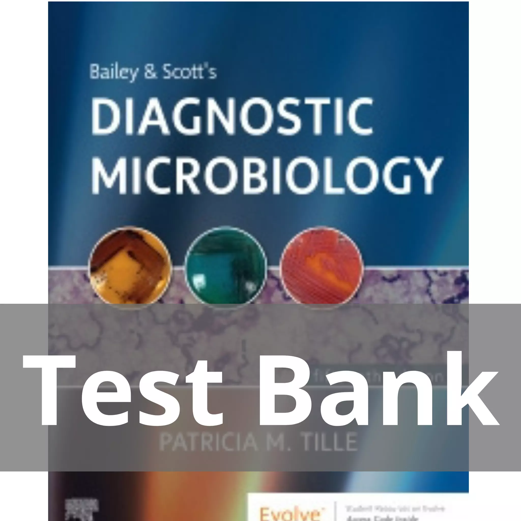 Bailey and Scott’s Diagnostic Microbiology 15th Editionby Patricia Tille Test Bank