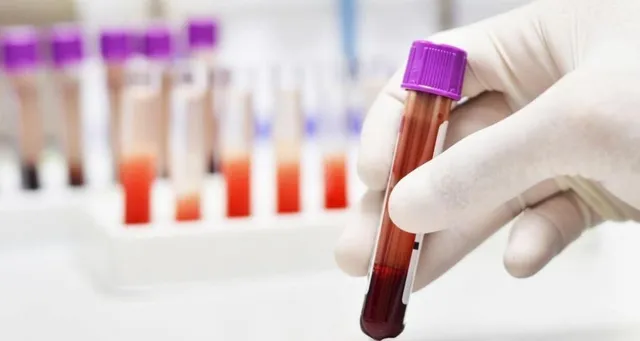 Contagem de Reticulocitos