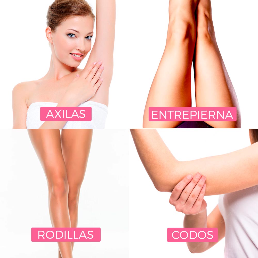 Blanqueamiento con Laser 