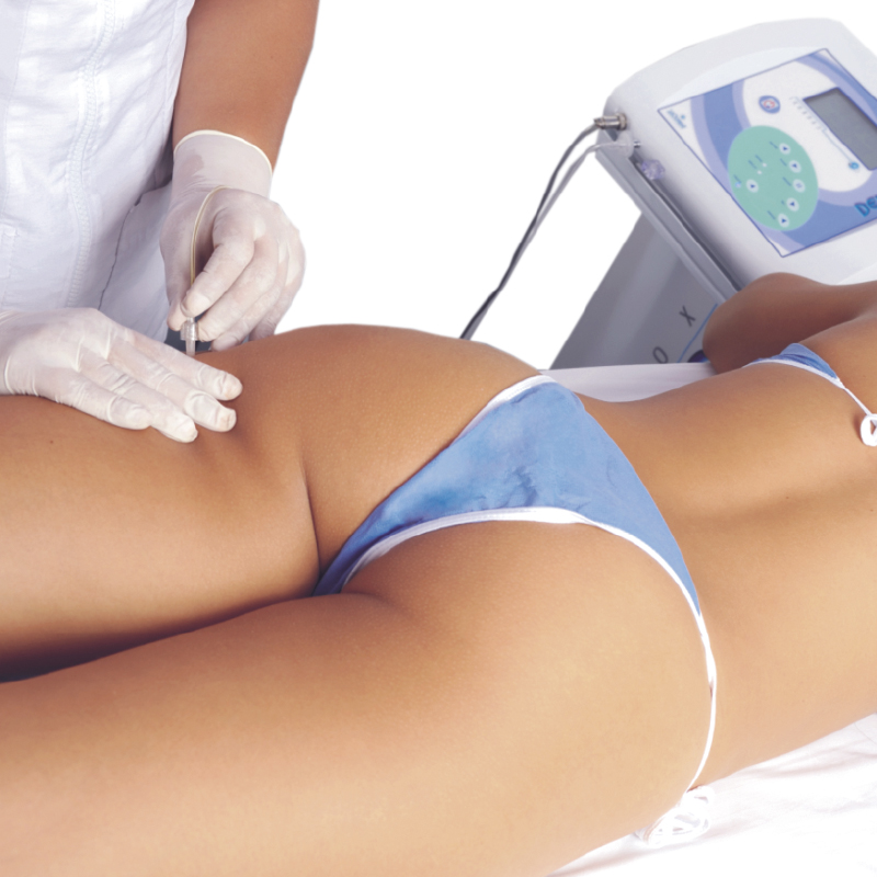 Carboxiterapia Corporal