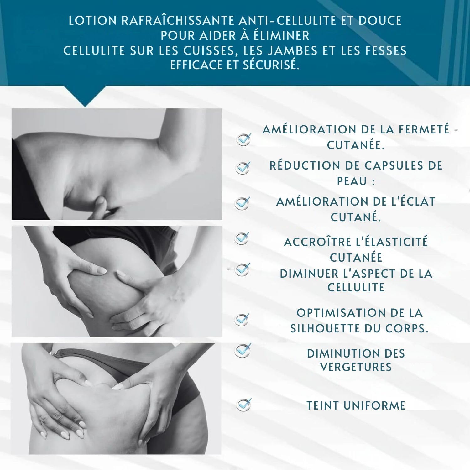 ANACIS CREME ANTI CELLULITE