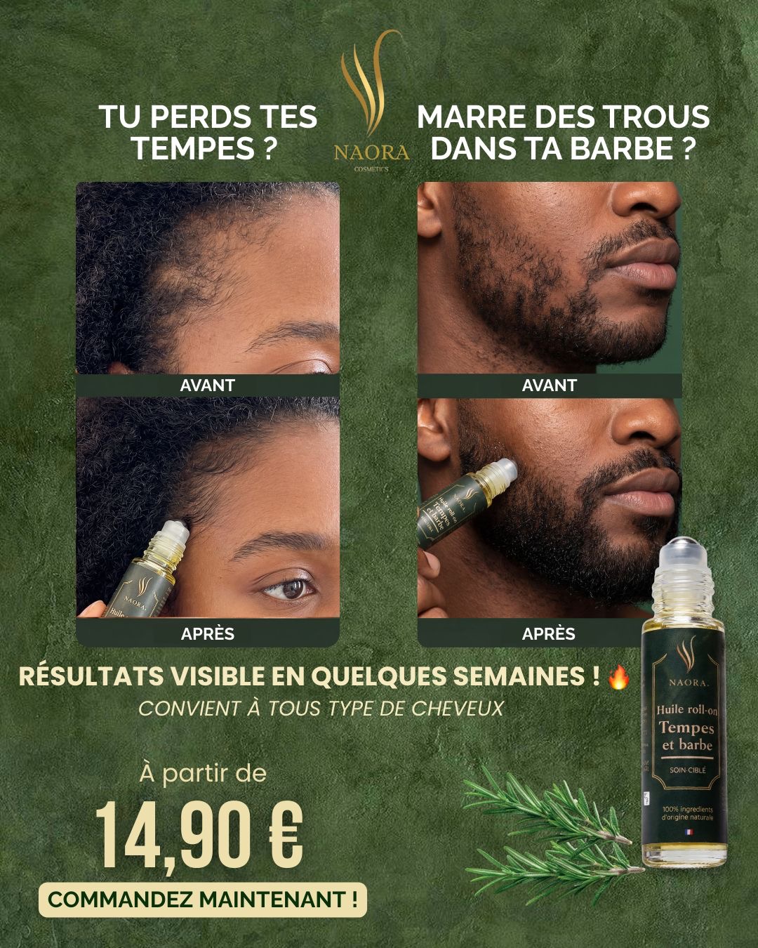 Densifie tes tempes & comble les trous de barbe en quelques semaines 🔥