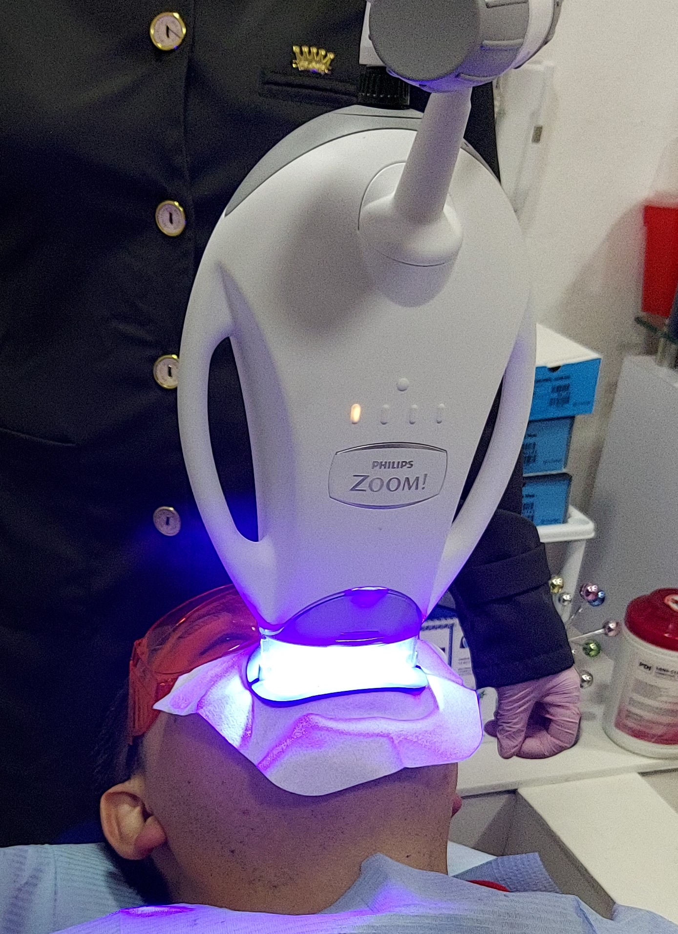 Blanqueamiento Dental