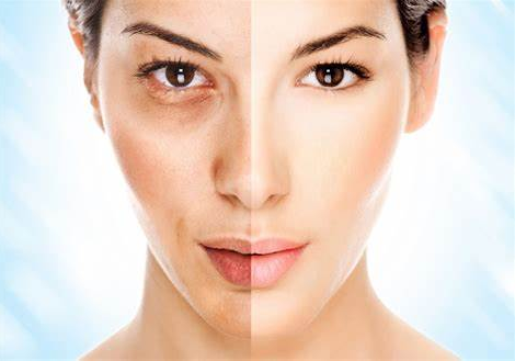 REJUVENESCIMENTO FACIAL