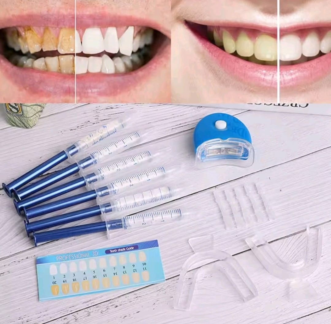 Kit de Blanqueamiento Dental