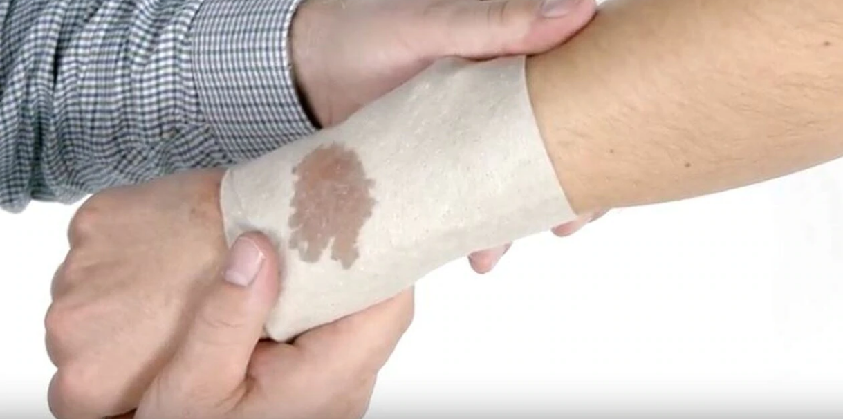 Absorbent Wound Dressing