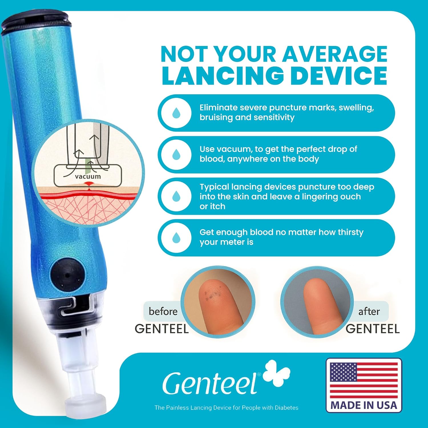 Genteel Plus Kit - Personal Lancing Device