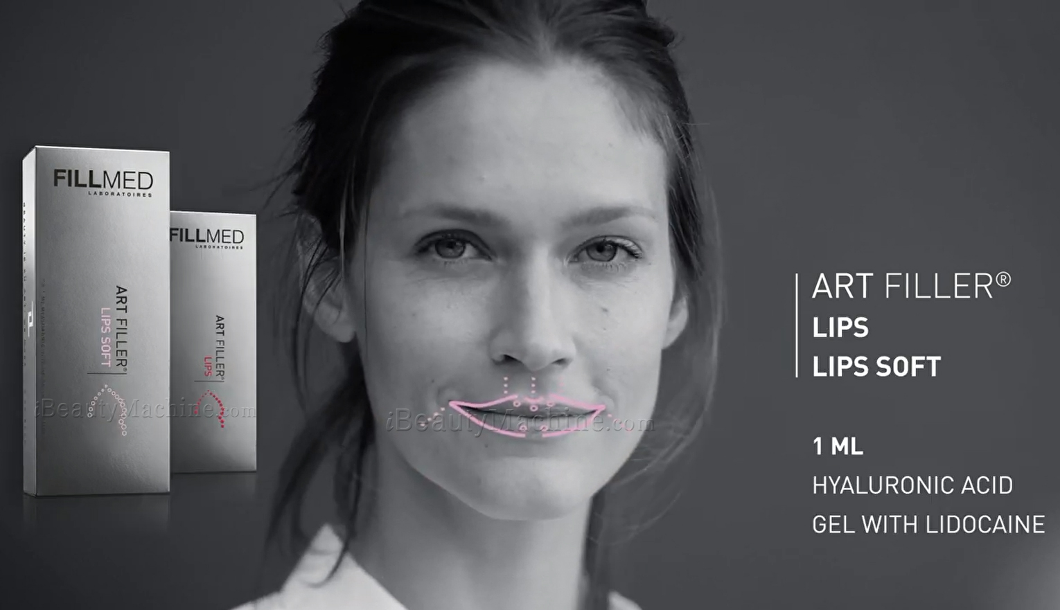 Perfilamiento de Labios con Ácido Hialurónico