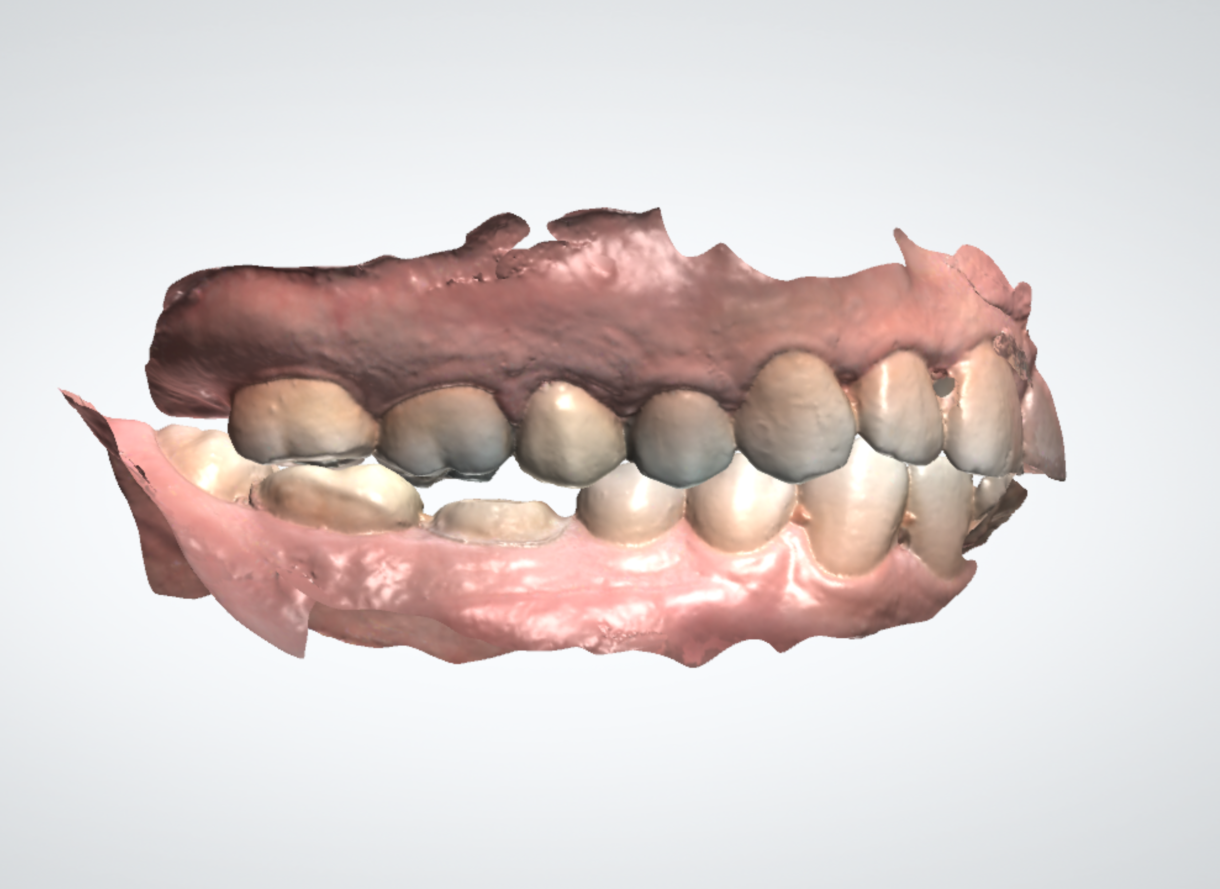 Servicio de escáner dental