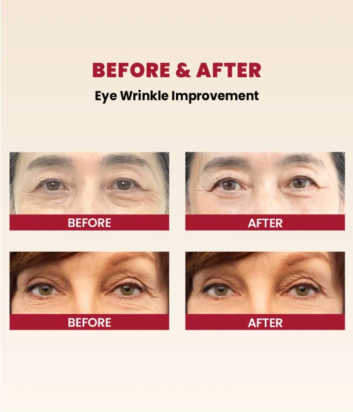 Crema Contorno de Ojos SEOUL 1988 Eye Cream : Retinal Liposome 4% + Fermented Bean