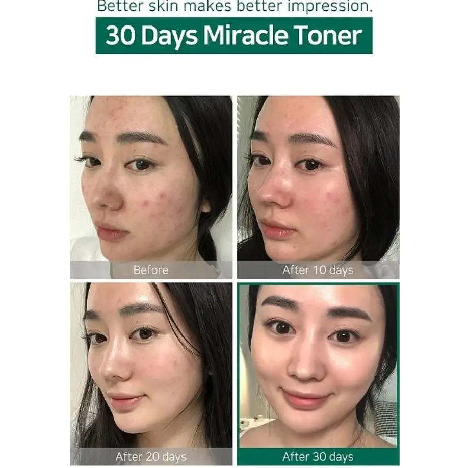 Tónico Facial AHA, BHA, PHA 30 Days Miracle Toner