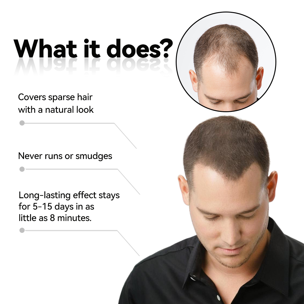 OEM 5-10 crème calvitie  Days Henna Plant Based Black Cover bald rarely Scalp Sparse Bald Root Liquid Thick Full Hair Look Hair Concealer Gel Paste Cream 