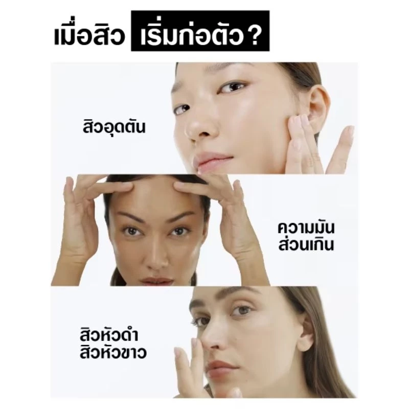 Neutrogena นูโทรจีนา โฟมล้างหน้า ดีพคลีน แอคเน่ โฟมมิ่ง คลีนเซอร์ 150กรัม Neutrogena DeepClean Acne Facial Cleanser 150.