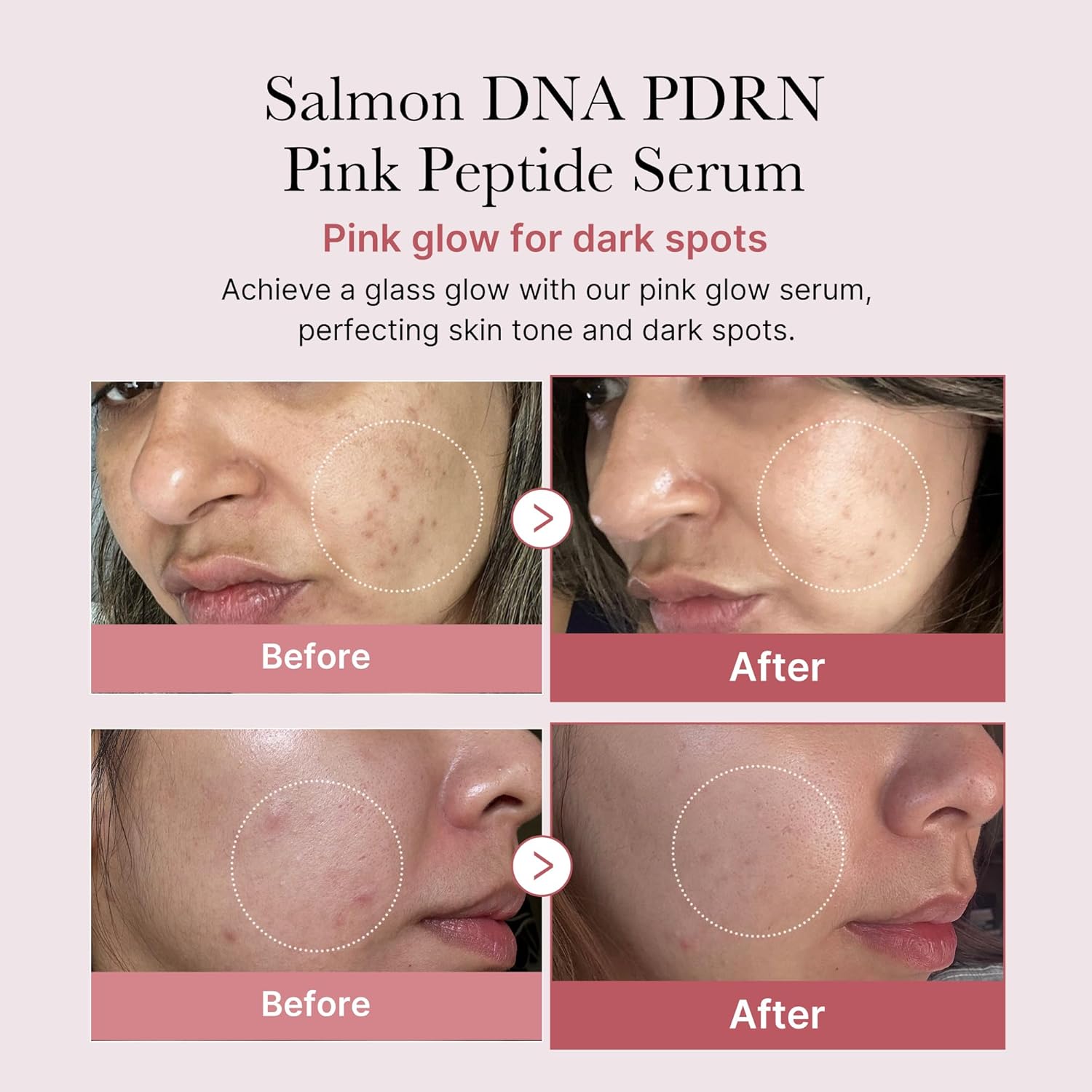 medicube Salmon DNA PDRN Pink Peptide Serum, Pink glow serum, Peptide, Niacinamide, Hydrating