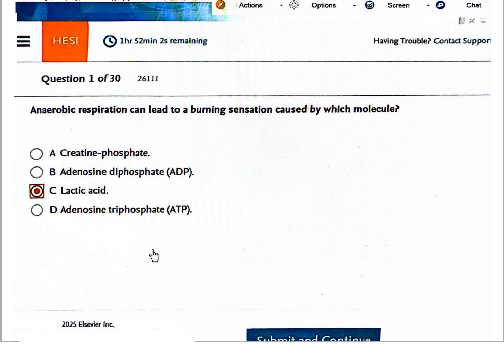 HESI D2 REVISION Questions