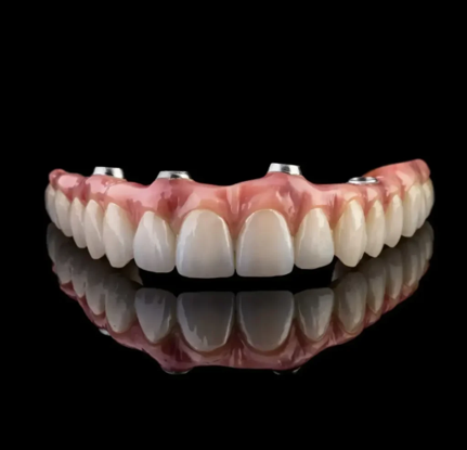 Full Implant Crown 