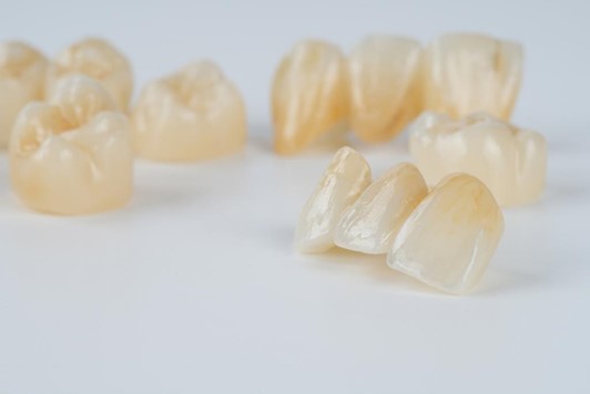 Layered-Zirconia Crown