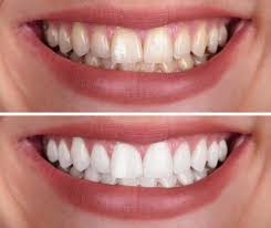 Add-On & Maintenance Treatments APPOINTMENT (DEPOSIT)
