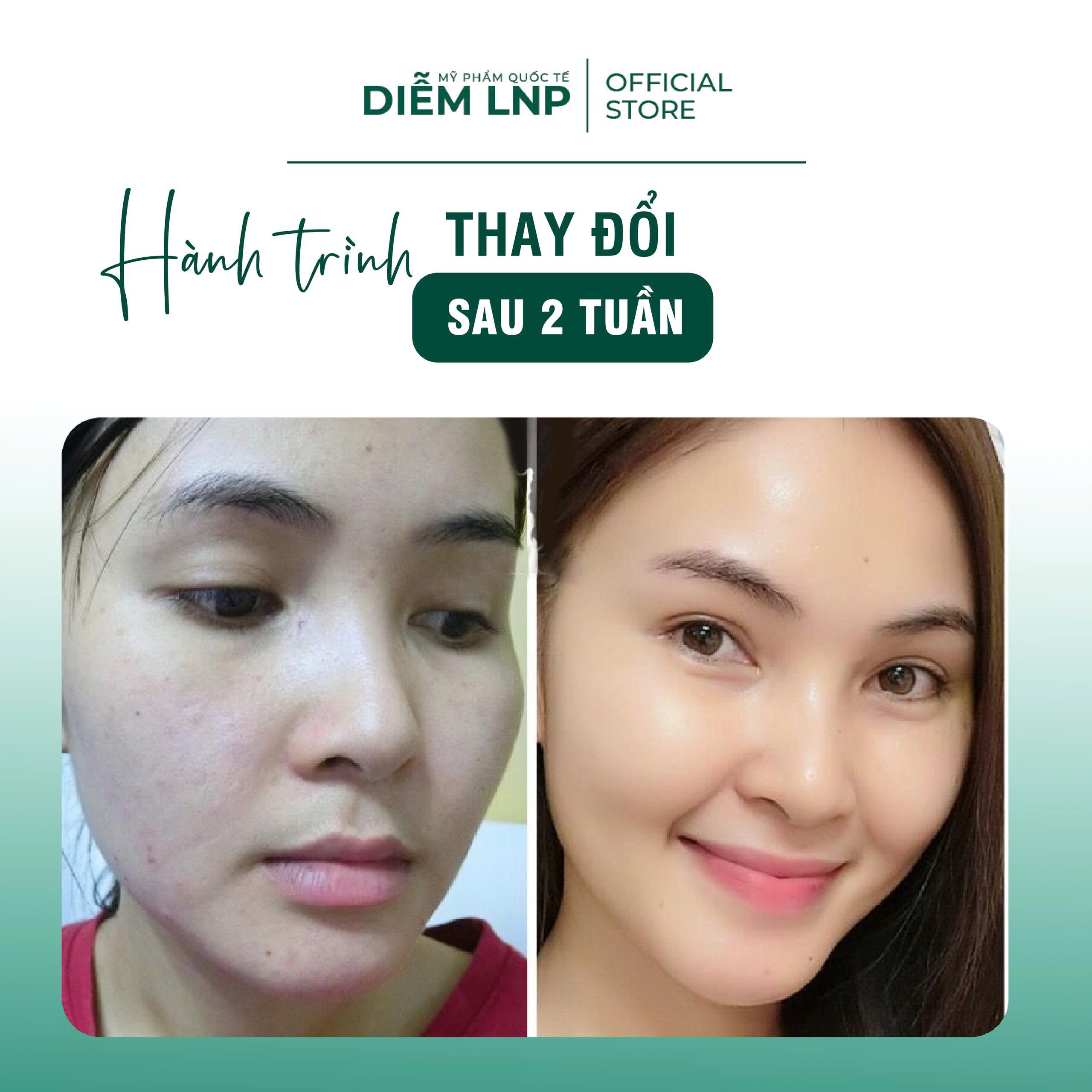 Kem Phục Hồi Da INKOBIO D4 Hàn Quốc 50ml- Làm Dịu, Chữa Lành Tự Nhiên, Dày Khoẻ, Căng Bóng Da