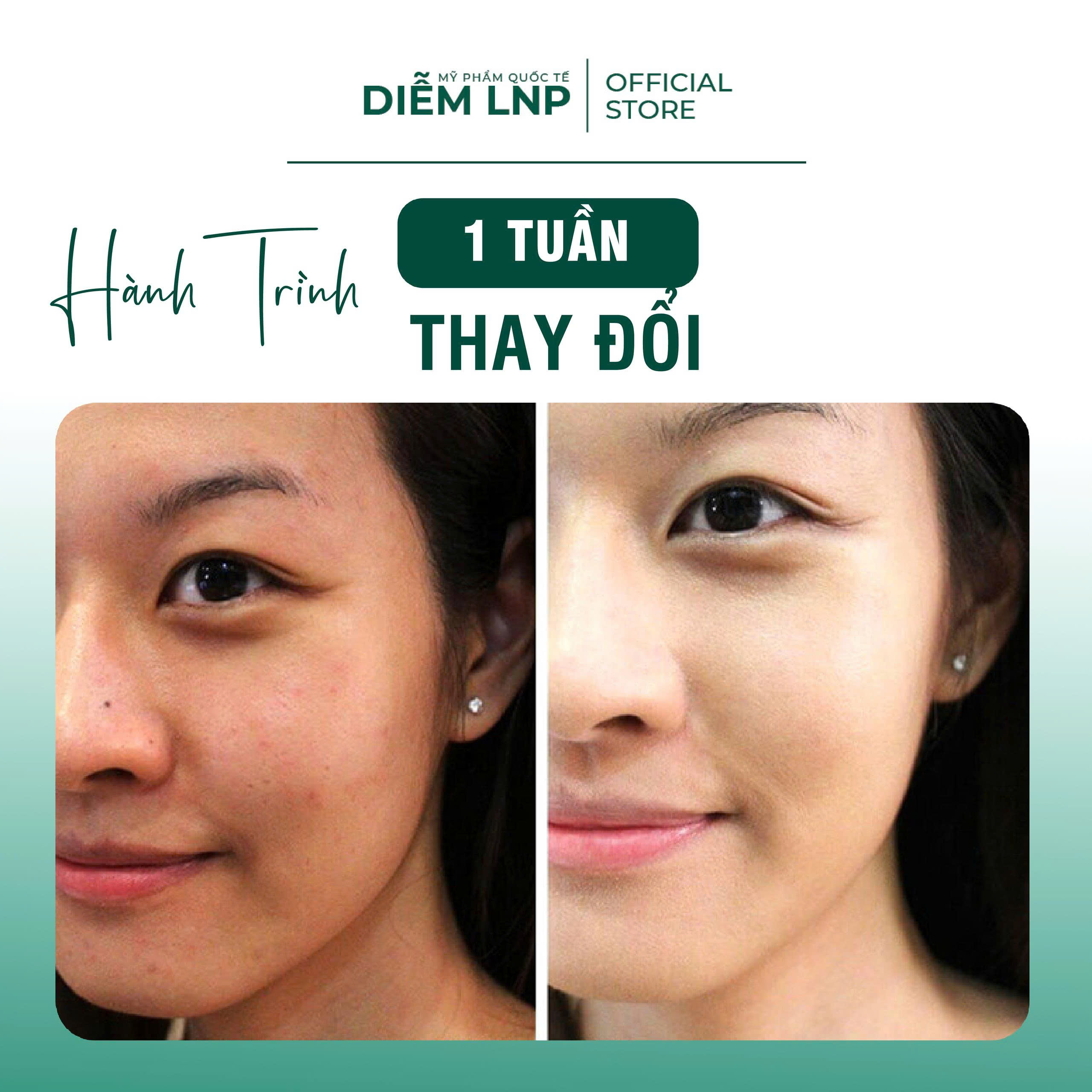 Toner INKOBIO D2 Hàn Quốc 150ml- Nước Cân Bằng Làm Dịu Da, Giảm Nhờn & Mụn, Cho Da Dầu Nhạy Cảm