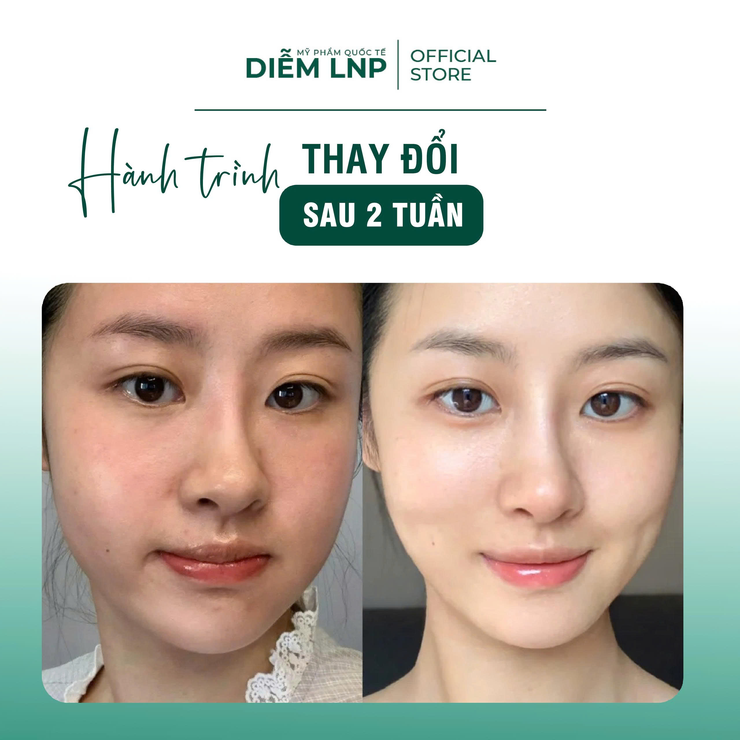 Sửa Rửa Mặt INKOBIO D1 Hàn Quốc 120ml- Làm Sạch Sâu, Dịu Nhẹ, Giảm Nhờn Mụn, Phù Hợp Da Nhạy Cảm