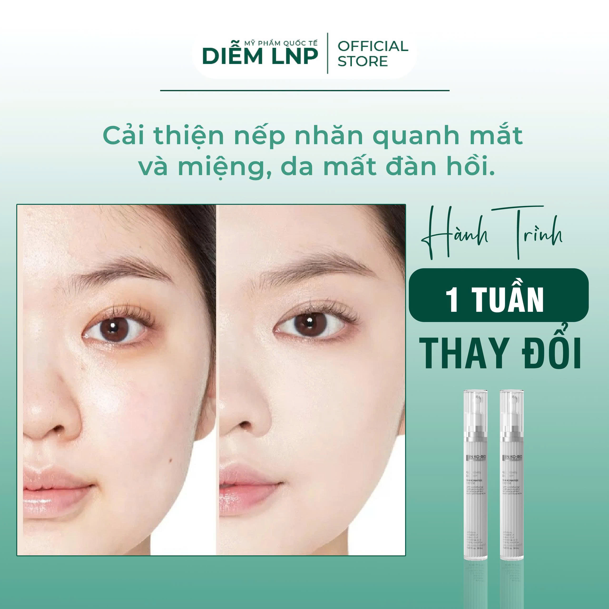 Kem mắt INKOBIO D5 Hàn Quốc 18ml- Bi Lăn Massage, Giảm Thâm, Xoá Nhăn, Giảm Bọng Mắt, Dưỡng sáng vùng mắt