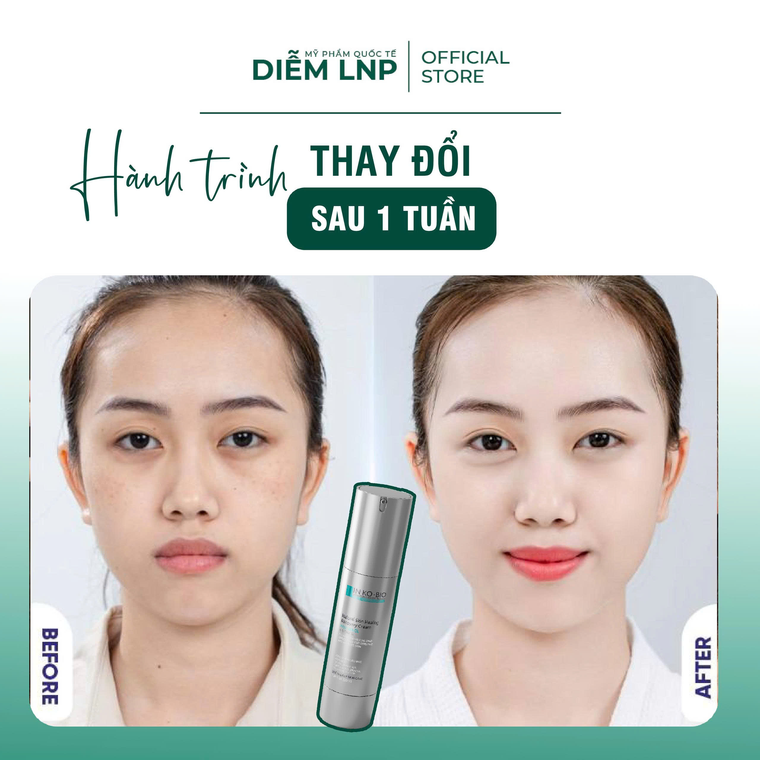 Combo Chăm Da Chuyên Sâu INKOBIO DS3- Vi Kim D3 + Phục Hồi D4 + Kem Mắt D5- Tái Sinh, Trẻ Hoá, Căng Bóng- Hàn Quốc