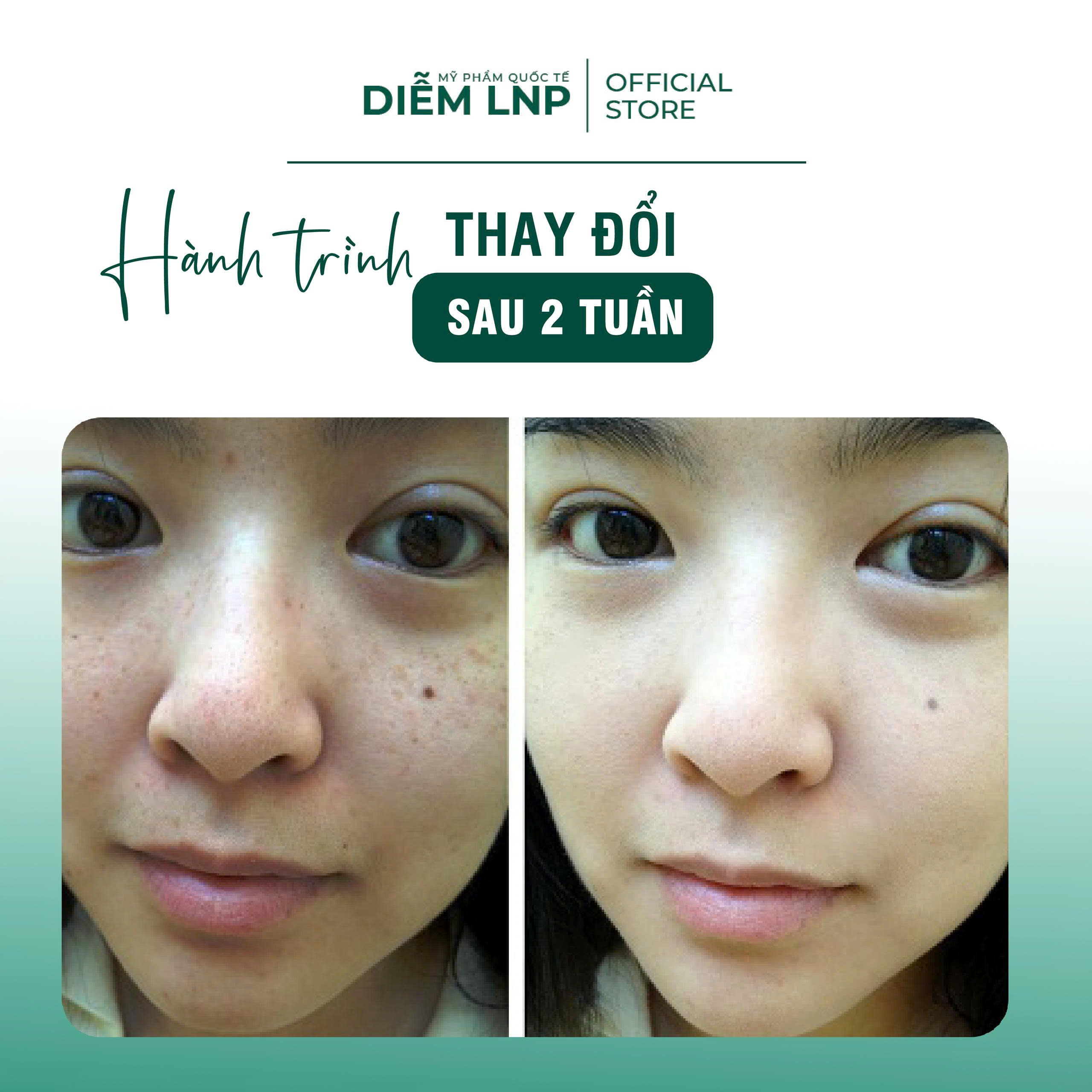 Kem Vi Kim INKOBIO D3 300 Shot Hàn Quốc 50ml- Trẻ Hoá Da, Căng Bóng, Mờ Nám, Giảm Mụn