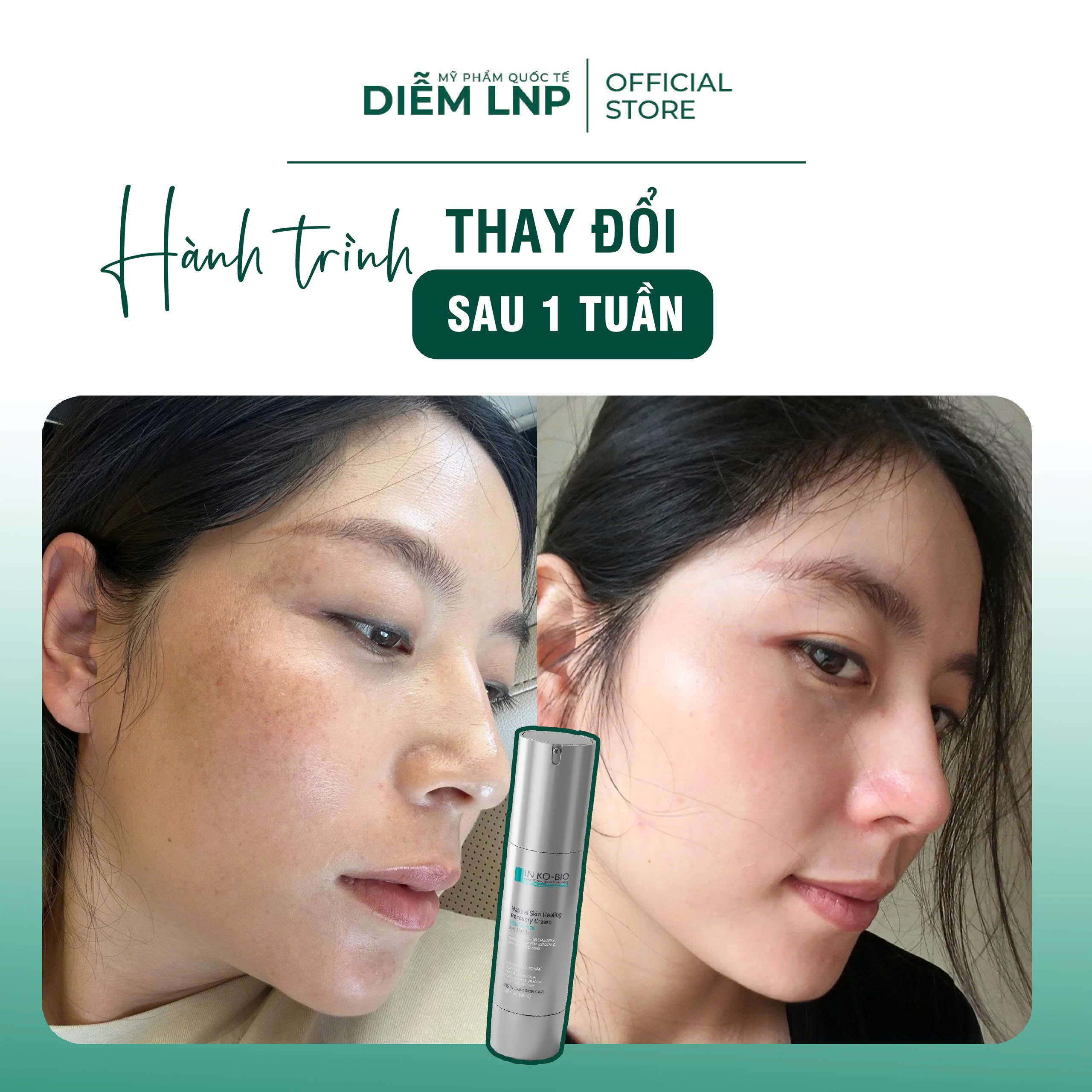 Combo Dưỡng Da & Mắt INKOBIO DP2- Phục Hồi D4 + Kem Mắt D5 - Giảm Nhăn, Dưỡng Ẩm Sâu, Trẻ Hoá Vùng Mắt- Hàn Quốc