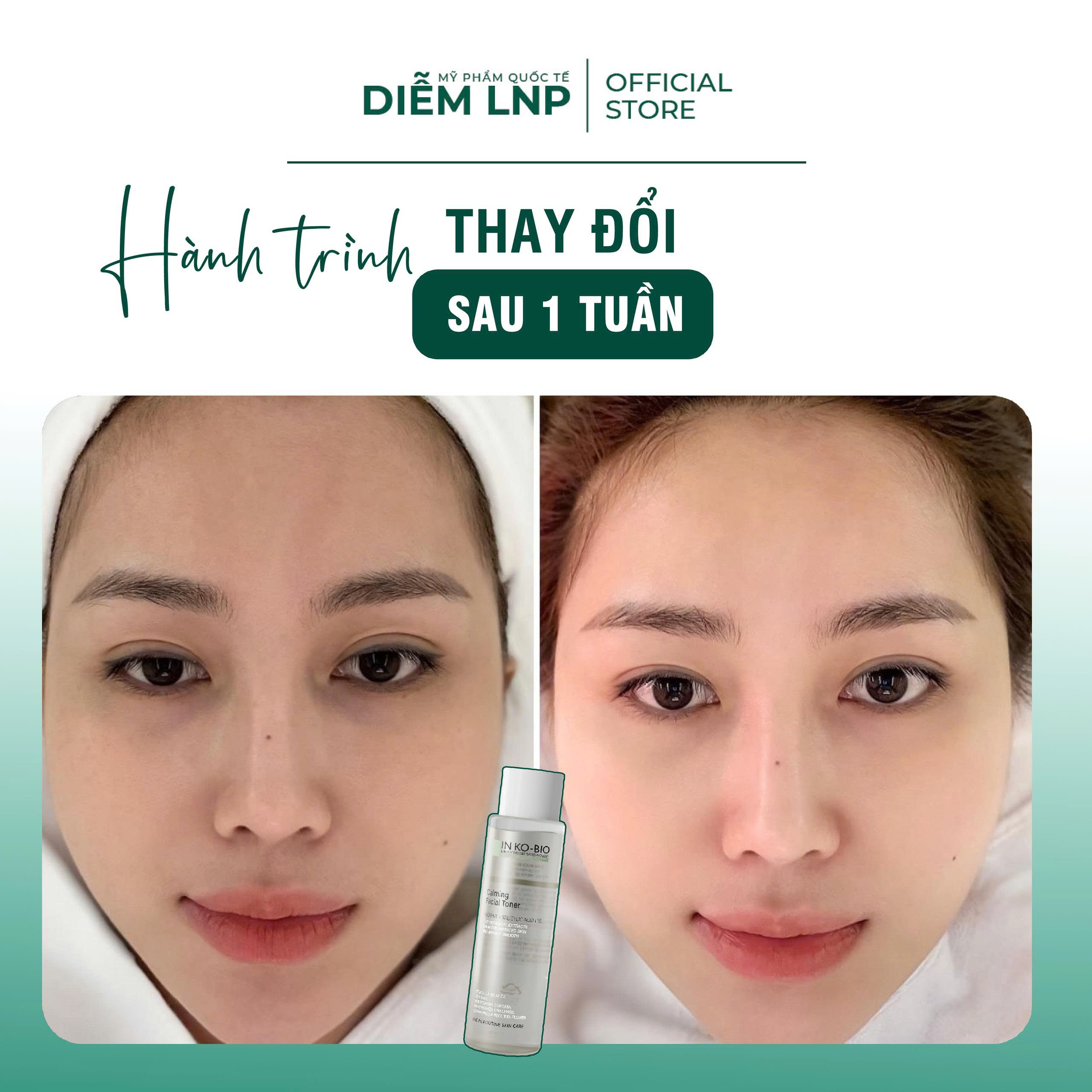 Combo Làm Sạch & Cân Bằng Da INKOBIO DC1- Sửa Rửa Mặt D1 + Tonner D2 - Cho Da Dầu & Nhạy Cảm- Hàn Quốc