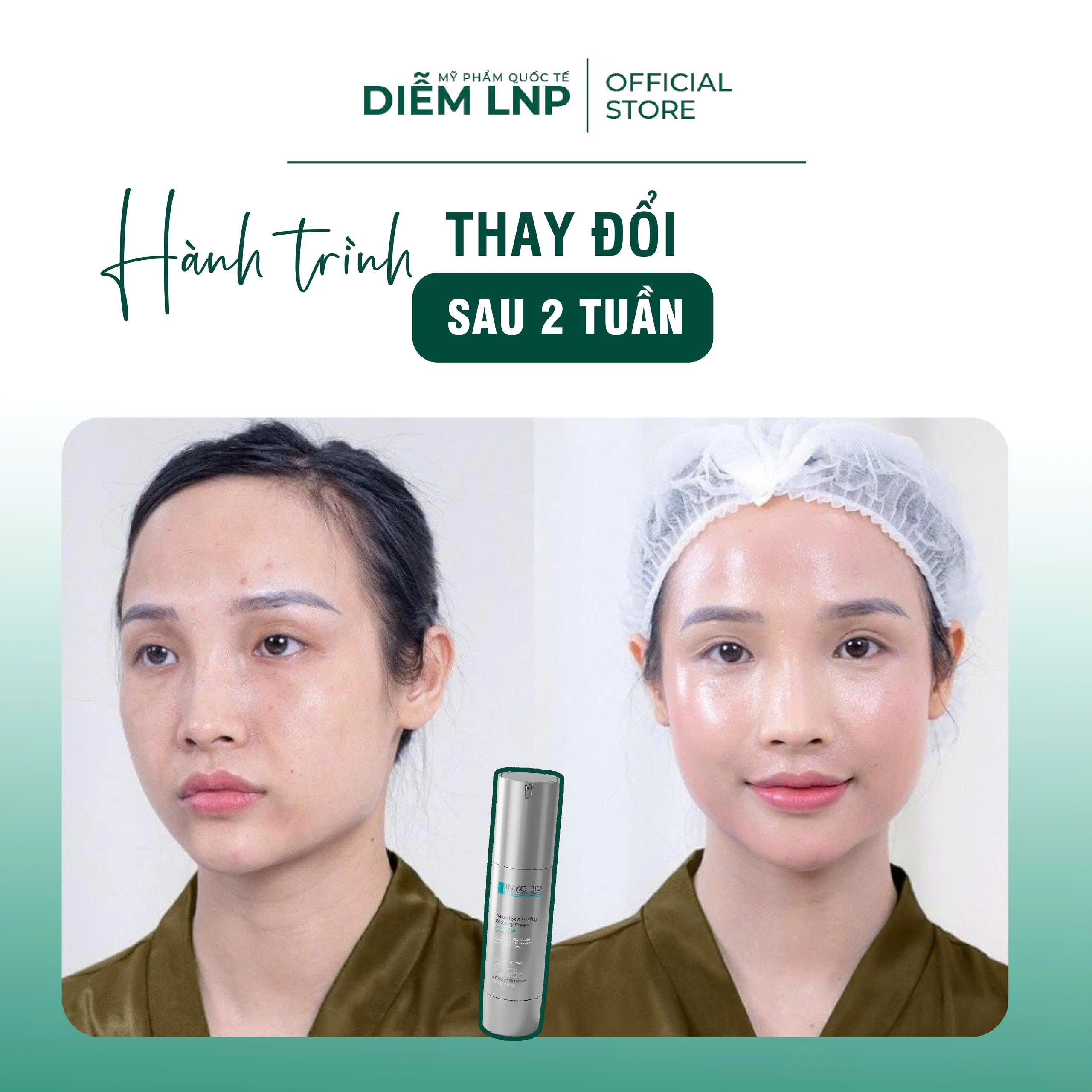 Combo Tái Sinh & Phục Hồi Da INKOBIO- Kem Vi Kim D3 + Kem Phục Hồi D4- Hàn Quốc
