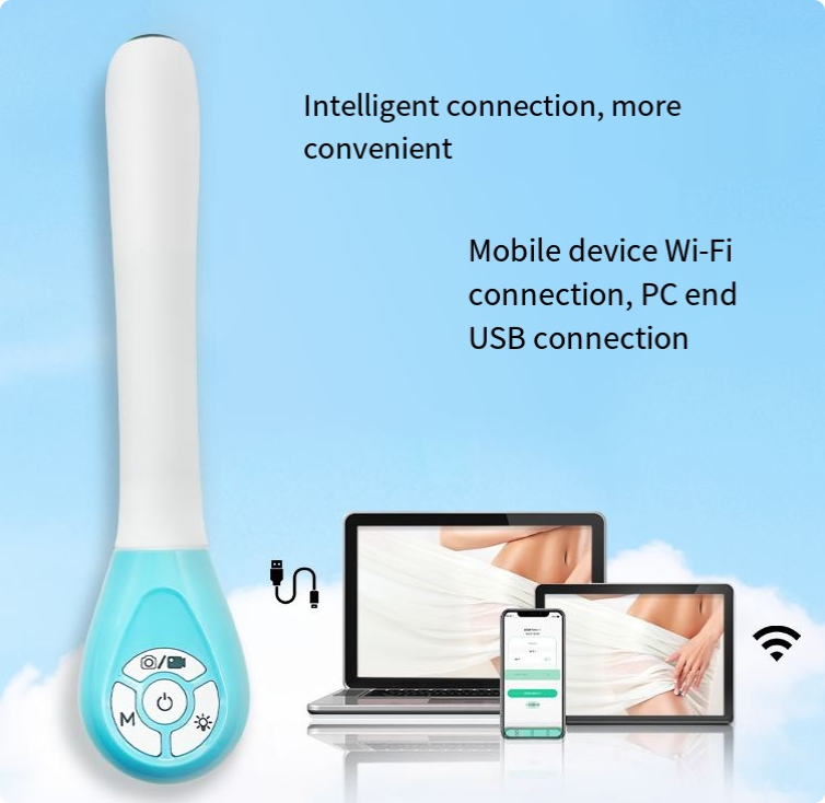 Wireless Vaginal Ultrasound Probe