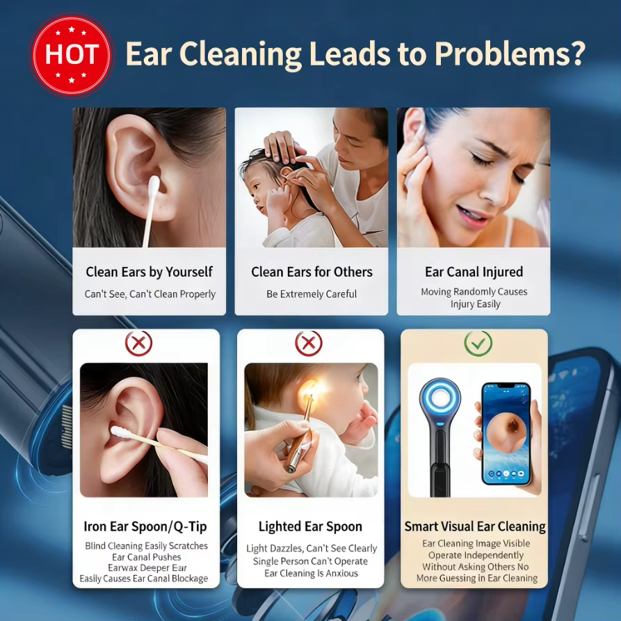 WIRELESS EAR ENDOSCOPE