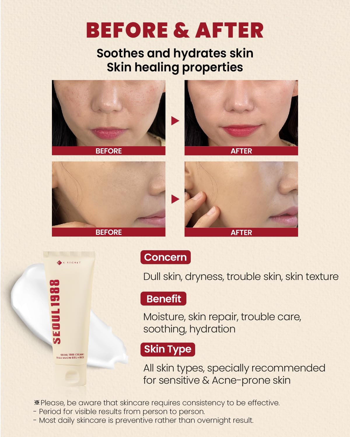 KSECRET Secret Seoul Snail & Rice 93% Extract Cream 100ml