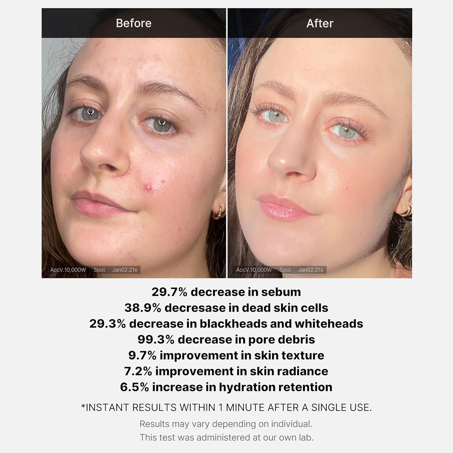 Medicube Red 21% Tri-acid Exfoliating Peel 40g  Acne Care With Hyaluronic & Succinic Acid
