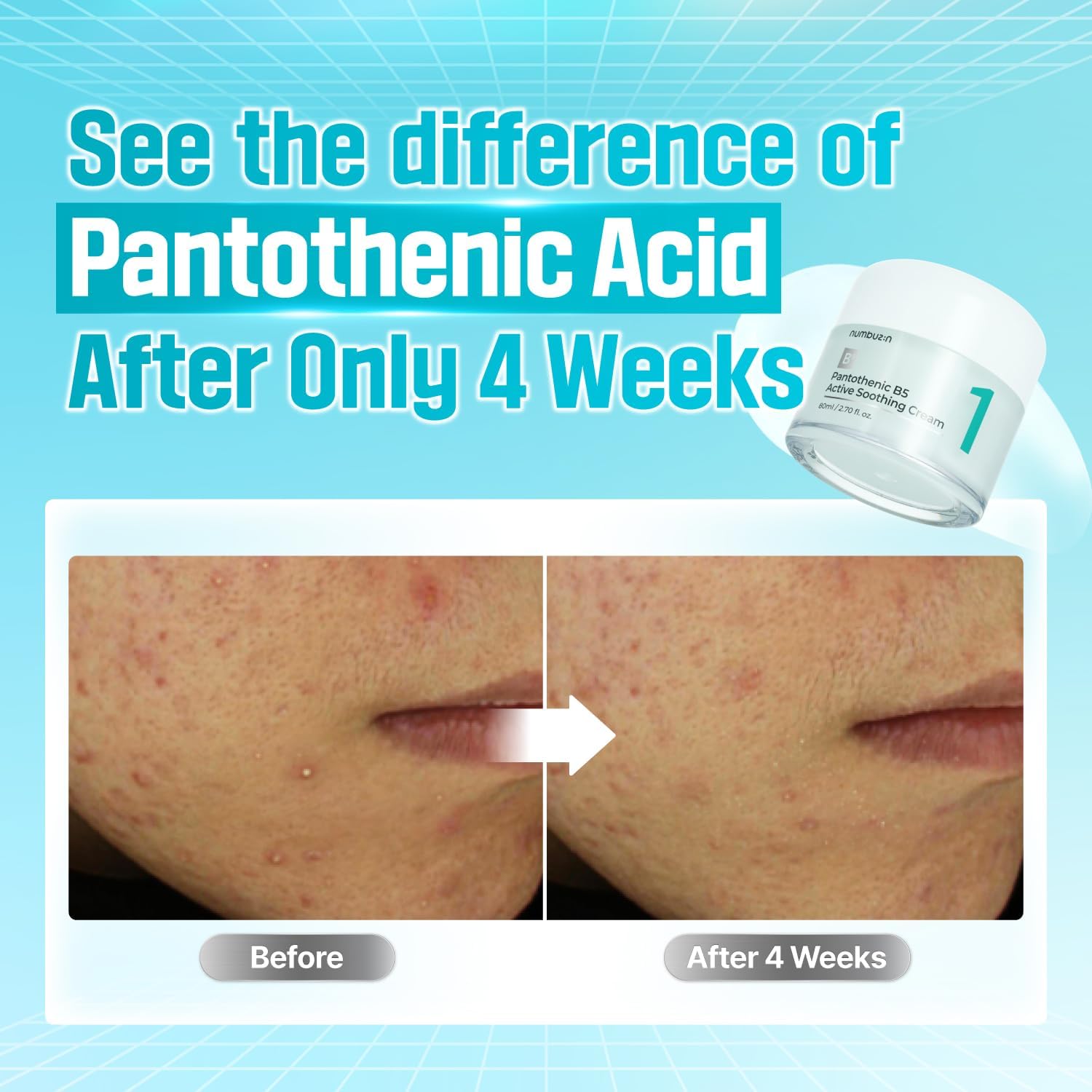 numbuzin No.1 Pantothenic B5 Active Soothing Cream | Lightweight Facial Moisturizer, Excess Oil Cont