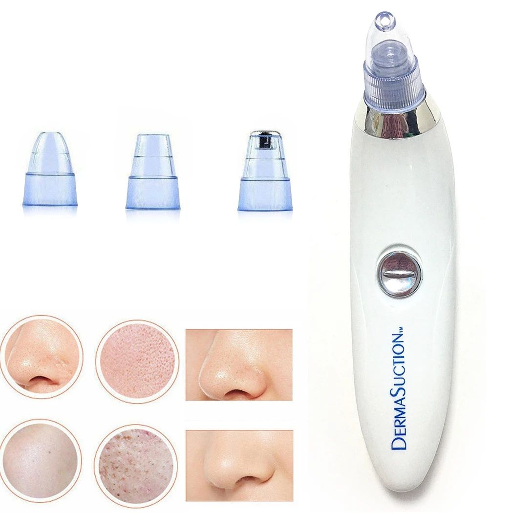4-in-1 Blackhead Remover & Derma Suction Machine