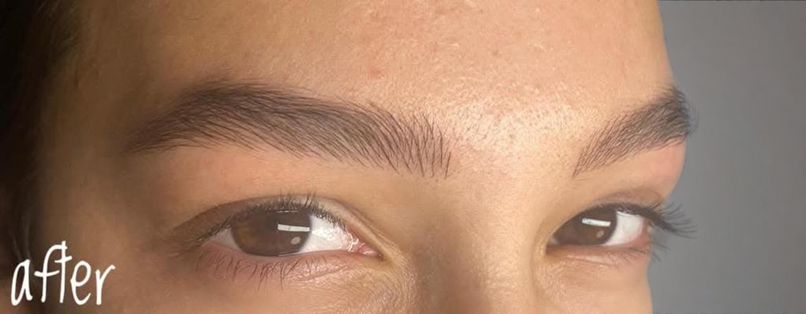 מיקרובליידינג לגבות