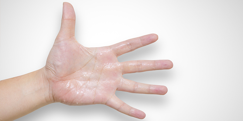 Hiperhidrosis