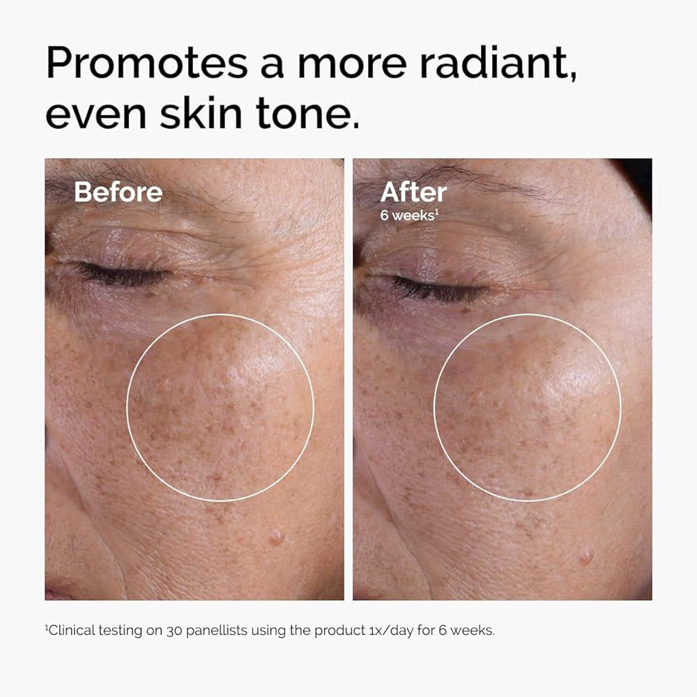 The Ordinary Glycolic Acid 7% Exfoliating Toner