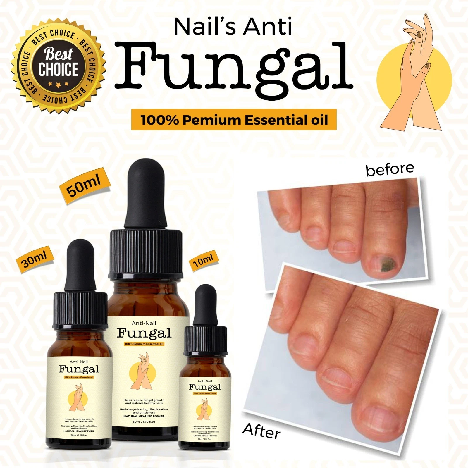Anti-Nail Fungal Treatment Oil - 10 ml 