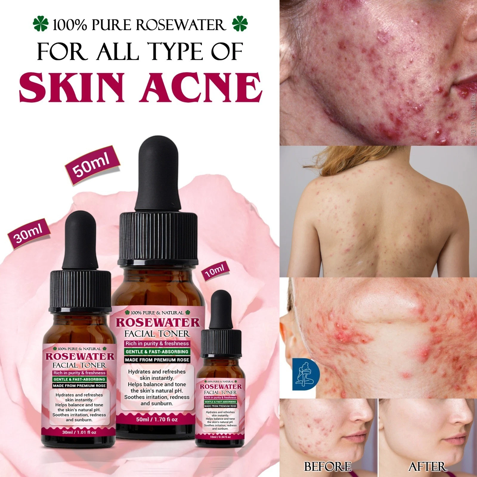 Face toner Non-Alcoholic/ face acne dark spots/100% natural